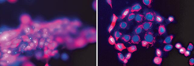 Unterschied von Zellschäden, herbeigeführt durch freie Radikale. A) Stark geschädigte Zellen ohne OM24®. B) Durch OM24® geschützte Zellen mit intaktem Zellkern (blau) und Mitochondrien (rot) 